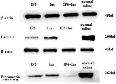 Western Blot: Fibronectin AntibodyBSA Free [NBP1-91258]