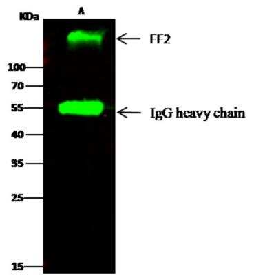 Immunoprecipitation: Fibronectin Antibody (014) [NBP2-89407]