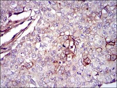 Immunohistochemistry-Paraffin: Fibronectin Antibody (2F4) - Azide and BSA Free [NBP2-80737]