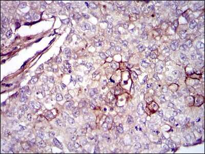 Immunohistochemistry-Paraffin: Fibronectin Antibody (2F4) - BSA Free [NBP2-22113]