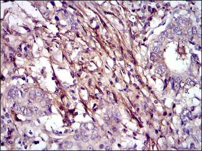 Immunohistochemistry-Paraffin: Fibronectin Antibody (2F4) - BSA Free [NBP2-22113]