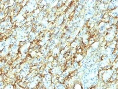 Immunohistochemistry-Paraffin: Fibronectin Antibody (568) - Azide and BSA Free [NBP2-48018]