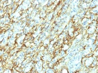 Immunohistochemistry-Paraffin: Fibronectin Antibody (568) [NBP2-45018]