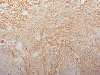 Immunohistochemistry-Paraffin: Fibronectin Antibody (HFN7.1) - Azide and BSA Free [NBP2-34633]