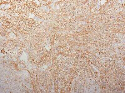 Immunohistochemistry-Paraffin: Fibronectin Antibody (HFN7.1) [NBP2-32847]