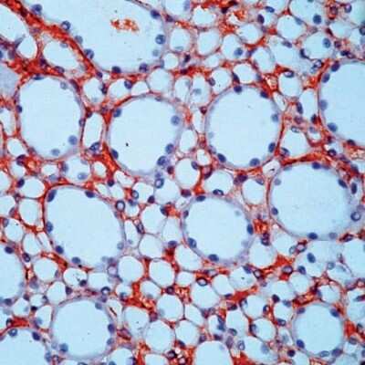 Immunohistochemistry-Paraffin: Fibronectin Antibody [NB110-41562]
