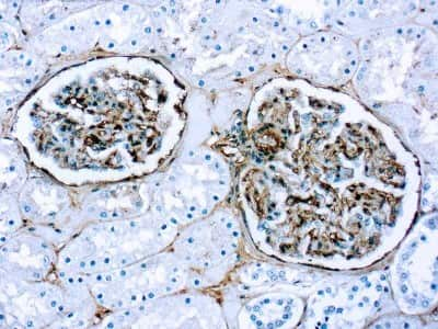 Immunohistochemistry-Paraffin: Fibronectin Antibody [NB110-41562]