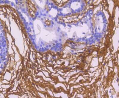 Immunohistochemistry-Paraffin: Fibronectin Antibody (JF0582) [NBP2-66845]