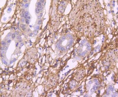 Immunohistochemistry-Paraffin: Fibronectin Antibody (JF0582) [NBP2-66845]