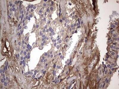 Immunohistochemistry: Fibronectin Antibody (OTI5C1) - Azide and BSA Free [NBP2-70762]