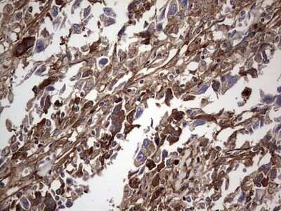 Immunohistochemistry: Fibronectin Antibody (OTI5C1) - Azide and BSA Free [NBP2-70762]