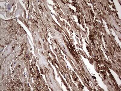 Immunohistochemistry: Fibronectin Antibody (OTI5C1) - Azide and BSA Free [NBP2-70762]