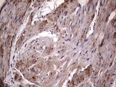 Immunohistochemistry: Fibronectin Antibody (OTI5C1) - Azide and BSA Free [NBP2-70762]