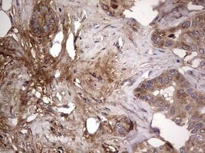 Immunohistochemistry: Fibronectin Antibody (OTI5C1) - Azide and BSA Free [NBP2-70762]