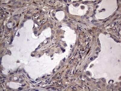 Immunohistochemistry: Fibronectin Antibody (OTI5C1) - Azide and BSA Free [NBP2-70762]