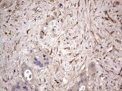 Immunohistochemistry: Fibronectin Antibody (OTI5C1) - Azide and BSA Free [NBP2-70762]