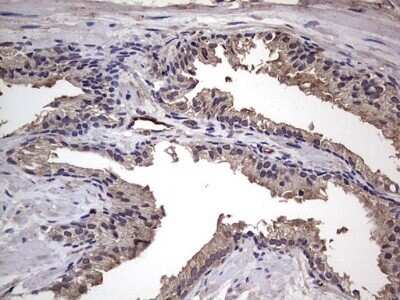 Immunohistochemistry: Fibronectin Antibody (OTI5C1) - Azide and BSA Free [NBP2-70762]