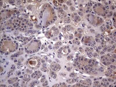 Immunohistochemistry: Fibronectin Antibody (OTI5C1) - Azide and BSA Free [NBP2-70762]