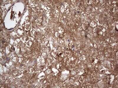 Immunohistochemistry: Fibronectin Antibody (OTI5C1) - Azide and BSA Free [NBP2-70762]
