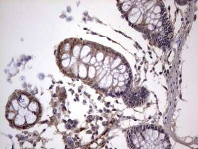 Immunohistochemistry: Fibronectin Antibody (OTI5C1) - Azide and BSA Free [NBP2-70762]