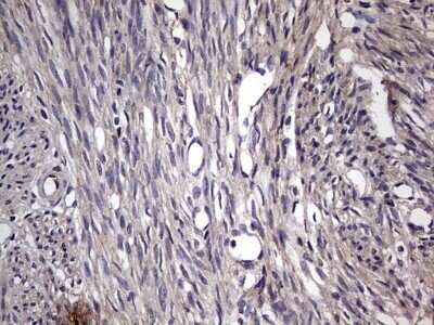 Immunohistochemistry: Fibronectin Antibody (OTI5C1) - Azide and BSA Free [NBP2-70762]