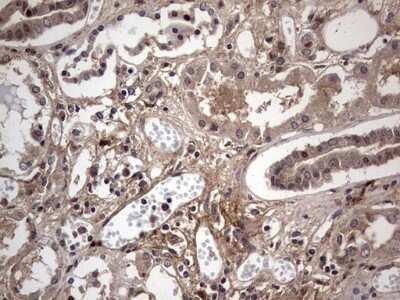 Immunohistochemistry: Fibronectin Antibody (OTI5C1) - Azide and BSA Free [NBP2-70762]