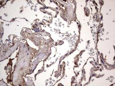 Immunohistochemistry: Fibronectin Antibody (OTI5C1) - Azide and BSA Free [NBP2-70762]