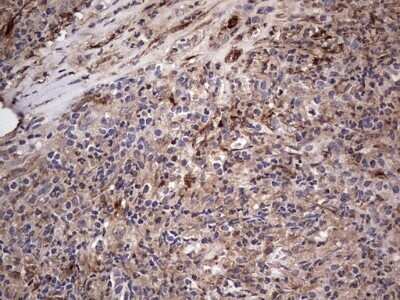 Immunohistochemistry: Fibronectin Antibody (OTI5C1) - Azide and BSA Free [NBP2-70762]
