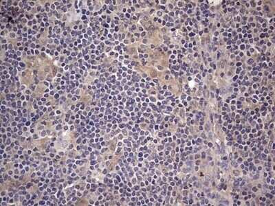 Immunohistochemistry: Fibronectin Antibody (OTI5C1) - Azide and BSA Free [NBP2-70762]