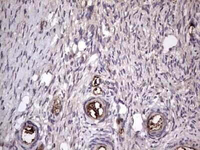 Immunohistochemistry: Fibronectin Antibody (OTI5C1) - Azide and BSA Free [NBP2-70762]