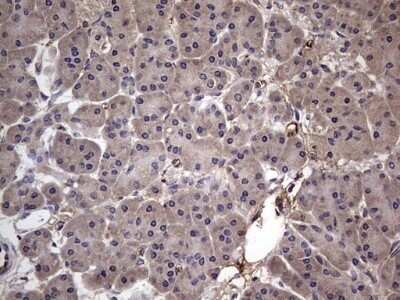 Immunohistochemistry: Fibronectin Antibody (OTI5C1) - Azide and BSA Free [NBP2-70762]