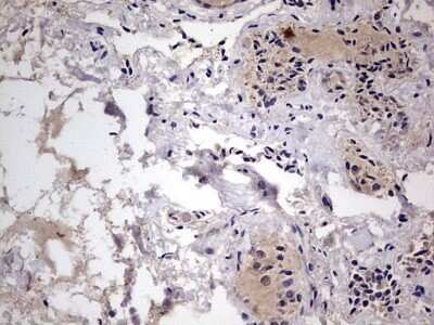 Immunohistochemistry: Fibronectin Antibody (OTI5C1) - Azide and BSA Free [NBP2-70762]