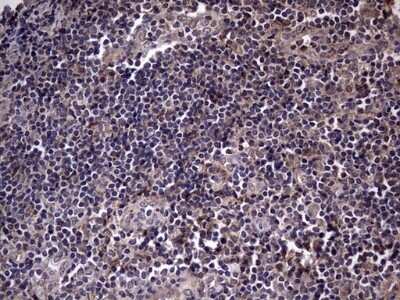 Immunohistochemistry: Fibronectin Antibody (OTI5C1) - Azide and BSA Free [NBP2-70762]