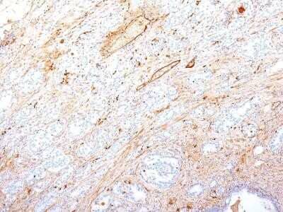 Immunohistochemistry-Paraffin: Fibronectin Antibody (SPM246) - Azide and BSA Free [NBP2-34749]