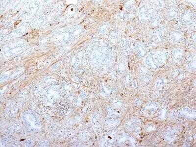 Immunohistochemistry-Paraffin: Fibronectin Antibody (SPM539) - Azide and BSA Free [NBP2-34785]