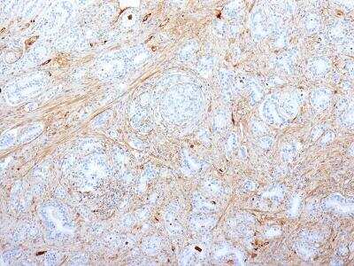 Immunohistochemistry-Paraffin: Fibronectin Antibody (SPM539) [NBP2-32848]