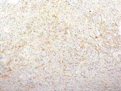 Immunohistochemistry-Paraffin: Fibronectin Antibody (TV-1) - Azide and BSA Free [NBP2-34504]