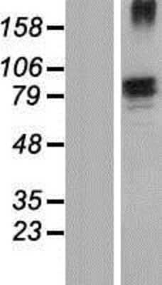 Western Blot: Fibronectin Overexpression Lysate [NBP2-04486]