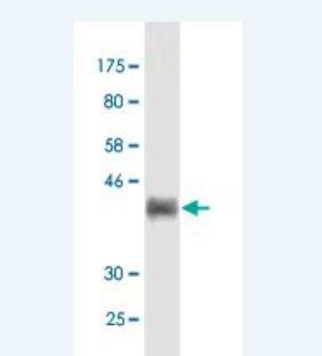 Western Blot: Fibulin 1 Antibody (2G9) [H00002192-M02]