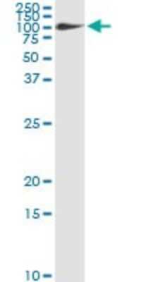 Immunoprecipitation: Fibulin 1 Antibody (4C9) [H00002192-M01]