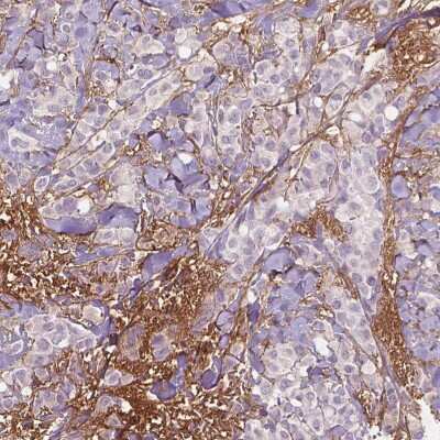 Immunohistochemistry-Paraffin: Fibulin 1 Antibody (CL0337) [NBP2-52918]
