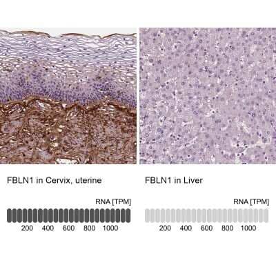 Immunohistochemistry-Paraffin: Fibulin 1 Antibody (CL0337) [NBP2-52918]