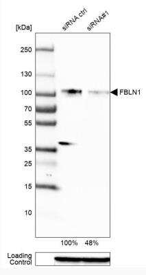 Western Blot: Fibulin 1 Antibody (CL0337) [NBP2-52918]