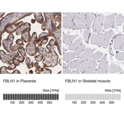 Immunohistochemistry-Paraffin: Fibulin 1 Antibody [NBP1-84725]