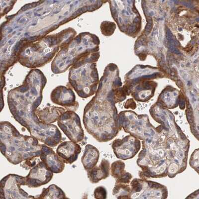 Immunohistochemistry-Paraffin: Fibulin 1 Antibody [NBP1-84725]