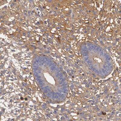 Immunohistochemistry-Paraffin: Fibulin 1 Antibody [NBP1-84725]