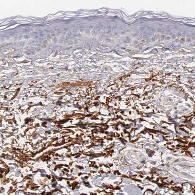 Immunohistochemistry-Paraffin: Fibulin 1 Antibody [NBP1-84725]