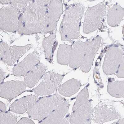 Immunohistochemistry-Paraffin: Fibulin 1 Antibody [NBP1-84725]