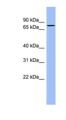 Western Blot: Fibulin 1 Antibody [NBP1-57911]