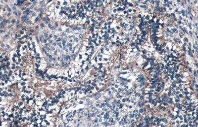 Immunohistochemistry-Paraffin: Fibulin 2 Antibody [NBP1-33479]
